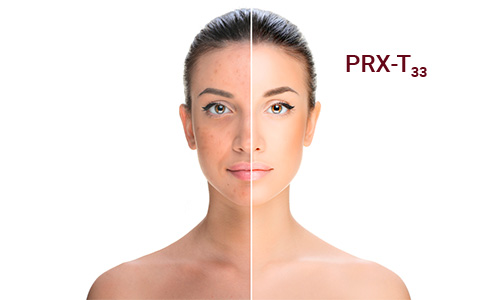 PRX-T33 Descubre el innovador tratamiento revitalizador sin agujas