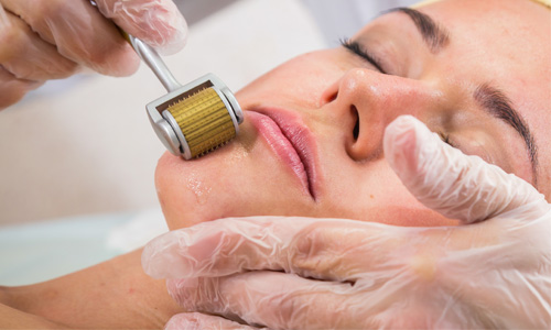 los-mejores-tratamientos-de-belleza-para-renovarse-marichecorrecher
