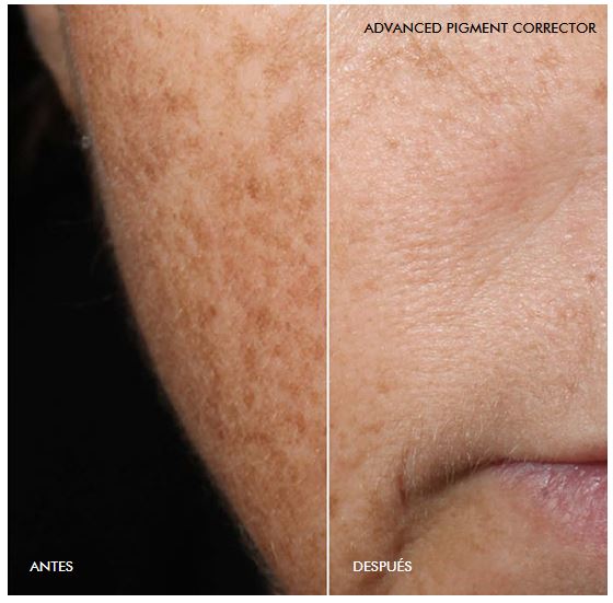 SkinCeuticals - marichecorrecher