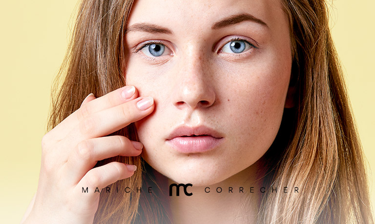 tratamientos para el acne - mariche correcher