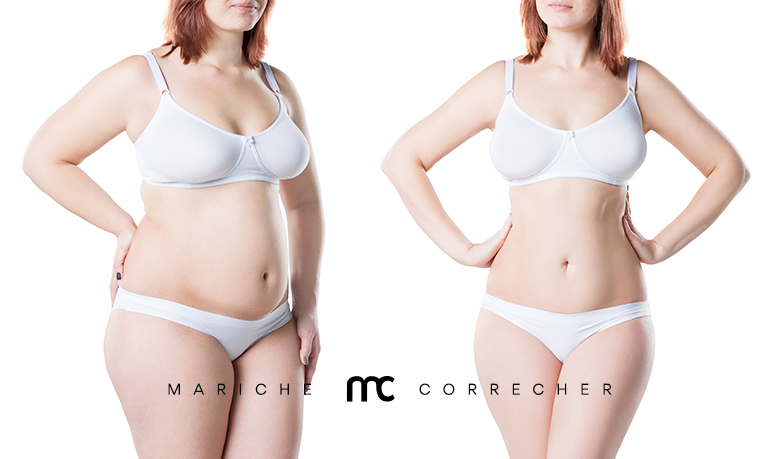 coolsculpting o liposuccion cual elegir - mariche correcher