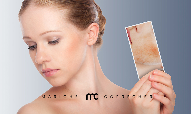 como quitar las manchas en la piel - mariche correcher